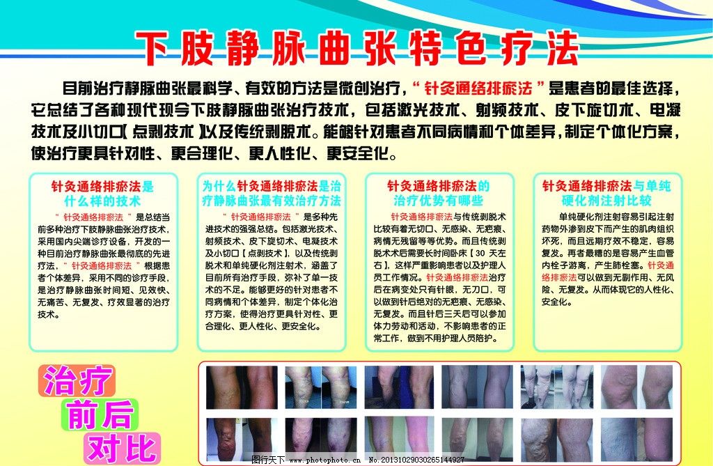 静脉曲张广告设计